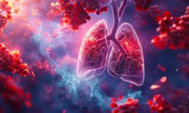 Understanding Pulmonary Embolism: A Potentially Life